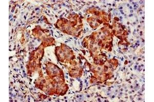 Immunohistochemistry of paraffin-embedded human pancreatic tissue using ABIN7171509 at dilution of 1:100 (TARDBP anticorps  (AA 1-396))