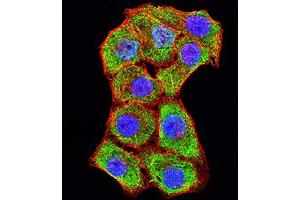 Immunofluorescence analysis of Hela cells using CD106 mouse mAb (green).