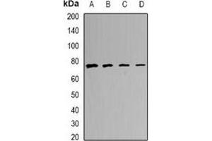 Western blot analysis of CALCOCO1 expression in MCF7 (A), A549 (B), mouse lung (C), mouse heart (D) whole cell lysates. (CALCOCO1 anticorps)