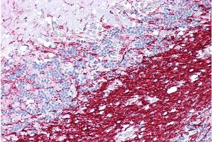 Immunohistochemistry with Brain, cerebellum tissue at an antibody concentration of 5µg/ml using anti-PLP1 antibody (ARP33843_P050)