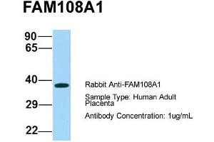 Host: Rabbit  Target Name: FAM108A1  Sample Tissue: Human Adult Placenta  Antibody Dilution: 1. (ABHD17A anticorps  (C-Term))