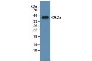 Detection of Recombinant CCK, Mouse using Polyclonal Antibody to Cholecystokinin (CCK) (Cholecystokinin anticorps  (AA 1-115))
