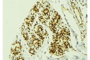 anti-GLI Family Zinc Finger 2 (GLI2) (N-Term) antibody