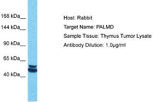 Host: Rabbit Target Name: PALMD Sample Tissue: Human Thymus Tumor Antibody Dilution: 1ug/ml (PALMD anticorps  (Middle Region))