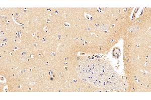 Detection of IL10Ra in Human Cerebrum Tissue using Polyclonal Antibody to Interleukin 10 Receptor Alpha (IL10Ra) (IL-10RA anticorps  (AA 132-235))