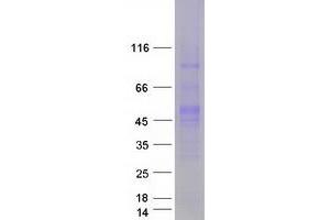 Validation with Western Blot