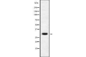Western blot analysis of MRPS15 using Jurkat whole cell lysates (MRPS15 anticorps  (Internal Region))