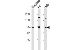 All lanes : Anti-SUZ12 Antibody (Center) at 1:2000 dilution Lane 1: mouse spleen lysates Lane 2: F9 whole cell lysates Lane 3: Hela whole cell lysates Lysates/proteins at 20 μg per lane. (SUZ12 anticorps  (AA 375-408))