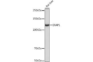 Western blot analysis of extracts of Rat liver, using ER Rabbit mAb (ABIN7266941) at 1:1000 dilution. (ERAP1 anticorps)