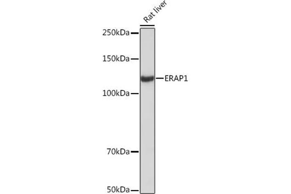 ERAP1 anticorps