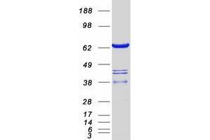 Validation with Western Blot