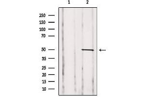 Western blot analysis of extracts from Mouse spleen, using GDI2 Antibody. (GDI2 anticorps  (Internal Region))