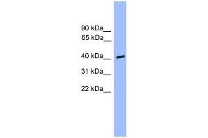 WB Suggested Anti-CSNK1A1L Antibody Titration: 0. (CSNK1A1L anticorps  (Middle Region))