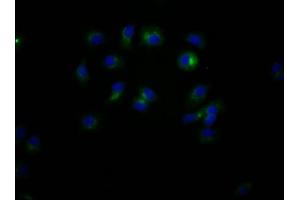 Immunofluorescence staining of MCF7 Cells with ABIN7127404 at 1:50, counter-stained with DAPI.