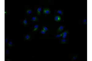 Immunofluorescence staining of MCF7 Cells with ABIN7127404 at 1:50, counter-stained with DAPI. (Recombinant CD47 anticorps)