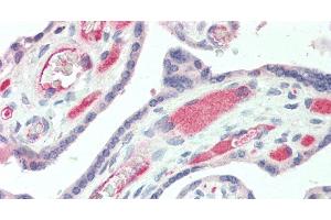 Immunohistochemistry of paraffin-embedded Human Placenta using IBSP Polyclonal Antibody at dilution of 1:50. (IBSP anticorps)
