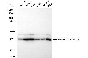 Western blotting analysis using MacroH2A. (Recombinant Histone, H2A1, Macro anticorps)