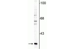 Western blot of rat cerebellar lysate showing specific immunolabeling of the ~29 kDa calretinin protein. (Calretinin anticorps)