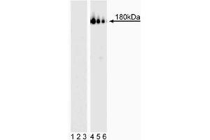 Western blot analysis of PDGFRbeta (pY857). (PDGFRB anticorps  (pTyr857))