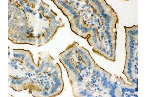 Anti- Plectin Picoband antibody, IHC(P) IHC(P): Mouse Intestine Tissue