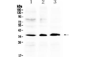 Western blot analysis of AKR1B10 using anti- AKR1B10 antibody . (AKR1B10 anticorps  (C-Term))