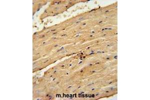 TIMP4 Antibody (Center) immunohistochemistry analysis in formalin fixed and paraffin embedded mouse heart tissue followed by peroxidase conjugation of the secondary antibody and DAB staining. (TIMP4 anticorps  (Middle Region))