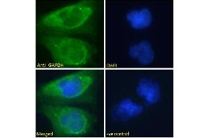 ABIN185543 Immunofluorescence analysis of paraformaldehyde fixed U251 cells, permeabilized with 0.