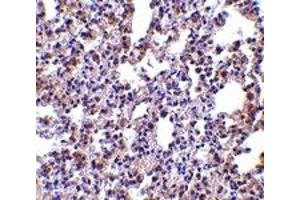 Immunohistochemistry (IHC) image for anti-Eukaryotic Translation Initiation Factor 2-alpha Kinase 2 (EIF2AK2) (C-Term) antibody (ABIN1030589) (EIF2AK2 anticorps  (C-Term))