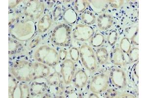 Immunohistochemistry of paraffin-embedded human kidney tissue using ABIN7175278 at dilution of 1:100 (MON1A anticorps  (AA 205-555))