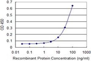 Detection limit for recombinant GST tagged RING1 is 1 ng/ml as a capture antibody.