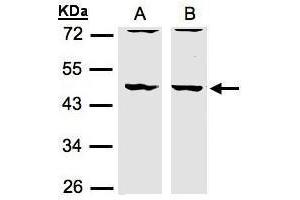 WB Image Sample(30 μg of whole cell lysate) A:HeLa S3, B:MOLT4, 10% SDS PAGE antibody diluted at 1:1500