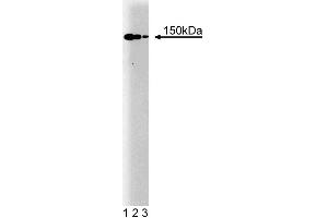 Western blot analysis of p150 [Glued] on a human endothelial cell lysate. (Dynactin 1 anticorps  (AA 3-202))