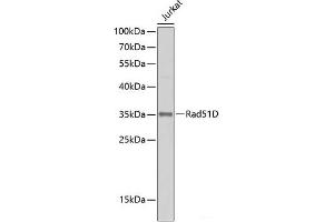 Western blot analysis of extracts of Jurkat cells using Rad51D Polyclonal Antibody at dilution of 1:500. (RAD51D anticorps)
