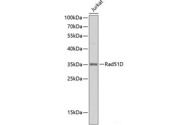 RAD51D 抗体