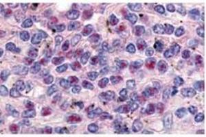 Anti-Cyclin L1a Antibody - Immunohistochemistry  anti-Cyclin L1a antibody was used at a 10 µg/ml to detect Cyclin L1ain a variety of tissues including breast (collagen), heart, kidney (distal tubules), liver, skeletal muscle, ovary (granulosa and oocyte), pancreas (islet), placenta (trophoblast), prostate (epithelium), skin, spleen (endothelium), stomach (chief), testes (seminiferous epithelium and leydig), thymus (Has-sal's corpuscle and lymphocytes) and uterus (glandular epithelium and stroma). (Cyclin L1 anticorps  (AA 314-369))