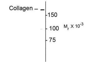 Image no. 1 for anti-Collagen, Type I (COL1) antibody (ABIN372599)