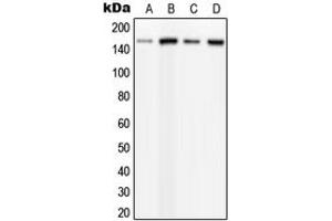 Western blot analysis of PLC beta 3 (pS537) expression in HeLa PMA-treated (A), MCF7 UV-treated (B), mouse brain (C), rat brain (D) whole cell lysates. (PLCB3 anticorps  (pSer537))