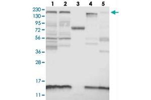 Western blot analysis of Lane 1: RT-4, Lane 2: U-251 MG, Lane 3: Human Plasma, Lane 4: Liver, Lane 5: Tonsil with KIAA1009 polyclonal antibody . (KIAA1009 (KIAA1009) anticorps)