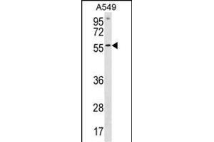 ETV5 Antibody (N-term) (ABIN1881325 and ABIN2838889) western blot analysis in A549 cell line lysates (35 μg/lane). (ETV5 anticorps  (N-Term))
