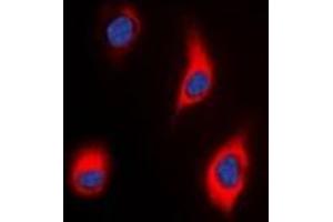 Immunofluorescent analysis of Tensin 3 staining in HeLa cells. (TNS3 anticorps)