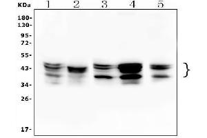 Western blot analysis of HNRNPD using anti-HNRNPD antibody (ABIN7602590).