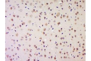 Formalin-fixed and paraffin embedded mouse brain labeled with Anti-LRP1/CD91 Polyclonal Antibody, Unconjugated  at 1:200 followed by conjugation to the secondary antibody and DAB staining. (LRP1 anticorps  (AA 4451-4545))