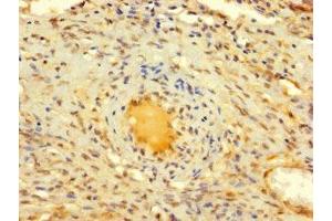 Immunohistochemistry of paraffin-embedded human ovarian tissue using ABIN7150017 at dilution of 1:100 (DIS3L2 anticorps  (AA 201-400))