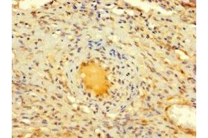 Immunohistochemistry of paraffin-embedded human ovarian tissue using ABIN7150017 at dilution of 1:100 (DIS3L2 anticorps  (AA 201-400))