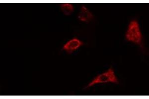 ABIN6274550 staining HepG2 cells by IF/ICC. (CHKB anticorps  (C-Term))