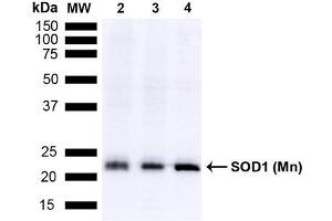 Western blot analysis of Mouse Brain, Rat Brain, and Rat Brain Membrane showing detection of 24. (SOD2 anticorps  (Atto 390))