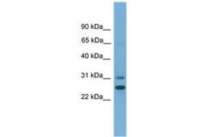Image no. 1 for anti-Dehydrogenase/reductase (SDR Family) Member 2 (DHRS2) (AA 27-76) antibody (ABIN6745489) (DHRS2 anticorps  (AA 27-76))