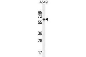 ZNF324B Antibody (C-term) western blot analysis in A549 cell line lysates (35 µg/lane). (ZNF324B anticorps  (C-Term))