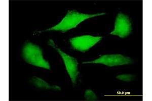 Immunofluorescence of purified MaxPab antibody to CDC25B on HeLa cell.