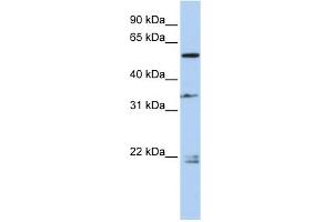 WB Suggested Anti-DPYSL2 Antibody Titration: 0. (DPYSL2 anticorps  (Middle Region))